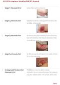 NUR 155 Skin Integrity & Wound Care &vert; Study Guide&comma; Practice Questions & Exam Review 2026&sol;2027