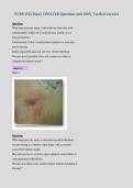 NURS 1512 Final &vert; UPDATED Questions with 100&percnt; Verified Answers&NewLine;