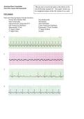 ACLS - Pre-Course Self Assessment & ECG Analysis Guide
