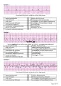 ACLS Pretest Latest SET