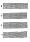 ACLS Pre-Test Rhythm Strips - Answers & Explanations