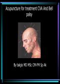 Acupuncture for CVA &lpar;Stroke&rpar; and Bell's Palsy Rehabilitation Notes &ndash; Dr&period; Balgis