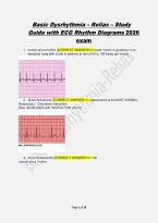 Basic Dysrhythmia &vert; Nursing Practice Questions and Answers for ECG Rhythm Interpretation
