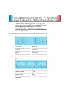 ECG Interpretation Made Incredibly Easy &ndash; Comprehensive ECG Rhythm Strip Practice Worksheets and Interpretation Exercises &lpar;Pages 320&ndash;357&rpar;