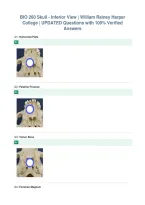 BIO 260 Skull - Inferior View &vert; William Rainey Harper&NewLine;College &vert; UPDATED Questions with 100&percnt; Verified&NewLine;Answers