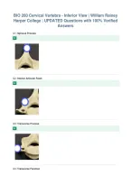 BIO 260 Cervical Vertebra - Inferior View &vert; William Rainey&NewLine;Harper College &vert; UPDATED Questions with 100&percnt; Verified&NewLine;Answers