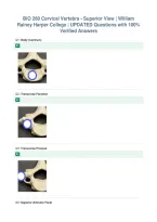 BIO 260 Cervical Vertebra - Superior View &vert; William&NewLine;Rainey Harper College &vert; UPDATED Questions with 100&percnt;&NewLine;Verified Answers