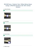 BIO 260 Femur - Posterior View &vert; William Rainey Harper&NewLine;College &vert; UPDATED Questions with 100&percnt; Verified&NewLine;Answers&NewLine;