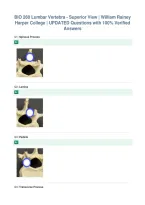 BIO 260 Lumbar Vertebra - Superior View &vert; William Rainey&NewLine;Harper College &vert; UPDATED Questions with 100&percnt; Verified&NewLine;Answers