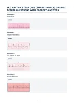 Ekg Rhythm Strip Quiz &lpar;Smarty Pance&rpar; Updated&NewLine;Actual Questions With Correct Answers