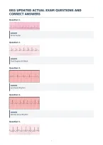 Ekg Strips Frequently Tested Actual Exam&NewLine;Questions With Correct Answers
