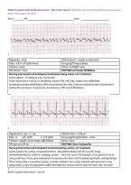 NR341 Complex Adult Health Assessment &ndash; EKG Rhythm Quiz with Complete Solution Latest 2026 Updated 