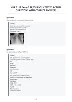 Nur 3112 Exam 5 Frequently Tested Actual&NewLine;Questions With Correct Answers