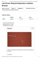 BIO 152 Essential Human Anatomy & Physiology II Lab 6 Exam Questions with 100&percnt; Correct Answers Fall 2026 &vert; Portage Learning &vert; Respondus LockDown Browser