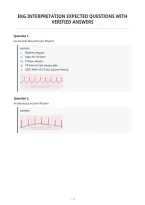 Ekg Interpretation Expected Questions With&NewLine;Verified Answers