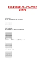 Ekg Examples - Practice &NewLine;Strips 