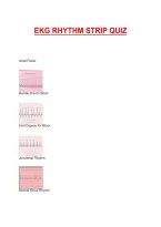 Ekg Rhythm Strip Quiz