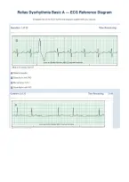 ACHIEVE RELIAS DYSRHYTHMIA BASIC WITH 100&percnt; VERIFIED TEST ANSWERS&vert; GRADE A&plus; 2026&period;