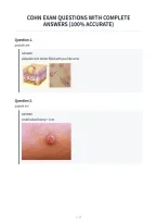 Cohn Exam Questions With Complete&NewLine;Answers &lpar;100&percnt; Accurate&rpar;