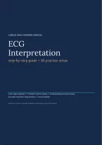 ECG Interpretation Made Simple&colon; Step-by-Step Guide with 17 Rhythm Strips &plus; 30 Practice Strips and Answers