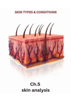 Milady Standard Esthetics Chapter 5 Notes&colon; Skin Analysis Comprehensive Study Guide & Practice Questions 