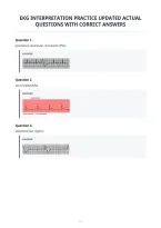 Ekg Interpretation Practice Updated Actual&NewLine;Questions With Correct Answers&NewLine;