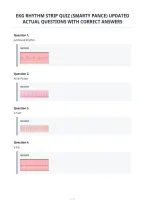 Ekg Rhythm Strip Quiz &lpar;Smarty Pance&rpar; Updated&NewLine;Actual Questions With Correct Answers