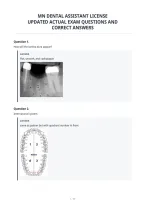 Mn Dental Assistant License&NewLine;Updated Actual Exam Questions And&NewLine;Correct Answers