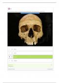 ASM 275 Lab 3 - Human Osteology and Anatomy BEST WITH ALL ANSWERS VERIFIED AND CORRECT