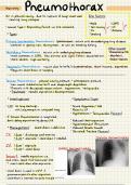 Pneumothorax - Summary Notes