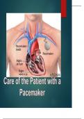 CARE OF THE PATIENT WITH A PACEMAKER SUMMARY LATEST VERSION