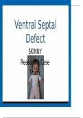 Ventral Septal Defect SKINNY Reasoning Mandy Gray, 2 months old