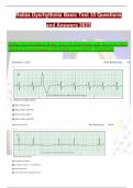 Relias Dysrhythmia Basic Test 35 Questions and Answers 2023 &lpar;BasicA Dysrhythmia&rpar; GRADED A LATEST VERSION