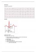 Learn to read ECG