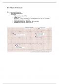 ECG; Patients with Chest pain