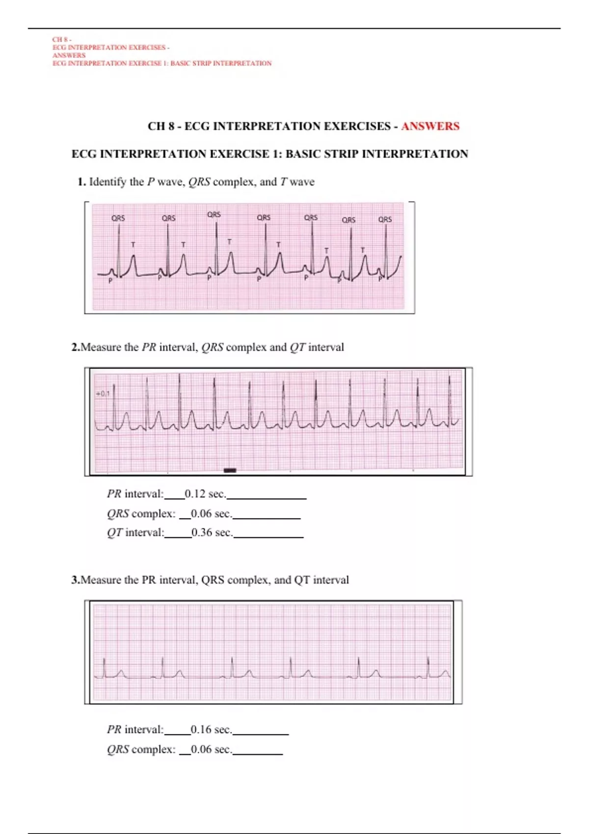 CH 8 ECG INTERPRETATION EXERCISES ANSWERS ECG INTERPRETATION