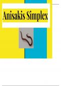 Presentación Anisakis Simplex
