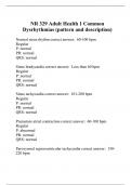 NR 329 Adult Health 1 Common Dysrhythmias (pattern and description)