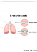 Bronchiectasis Notes