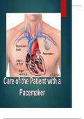 CARE OF THE PATIENT WITH A PEACE MAKER STUDY GUIDE