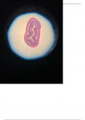 Histology of the Small Intestine (Jejunum) - Labeling Diagram