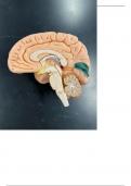 Sagittal Section Through Brain - Labeling Diagram