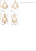 Atlas & Axis (Cervical Vertebrae) - Labeling Diagram