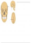 Parietal Bone (Cranium) - Labeling Diagram