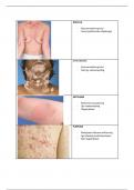 Overzicht huidaandoeningen met afbeeldingen