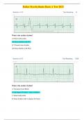 Relias Dysrhythmia Basic A Test 2023 &vert; Latest Update 