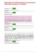 StaRN EKG Clep Test (50) Questions and Answers 2023-2024 Verified A+ Graded.