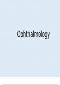 Ophthalmology (Medical School Finals Summary Notes)
