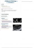 9. ovarian malignant pathology (obgyn ultrasound)