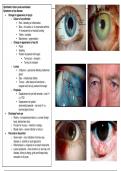 Ophthalmology notes 